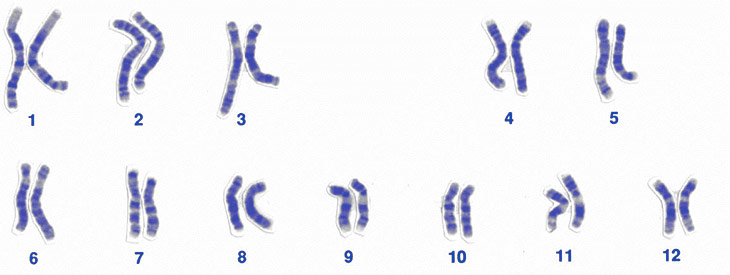 chromosome genetics